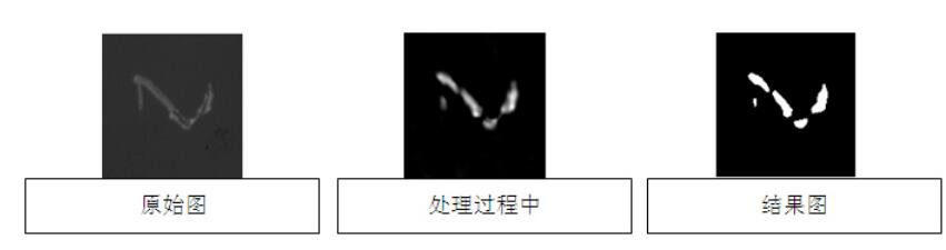 液晶屏幕視覺檢測，液晶屏幕劃痕污點缺陷檢測方案-機器視覺_視覺檢測設(shè)備_3D視覺_缺陷檢測